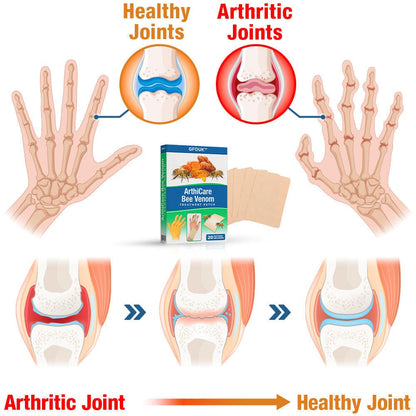 GFOUK™ ArthiCare Bee Venom Treatment Patch
